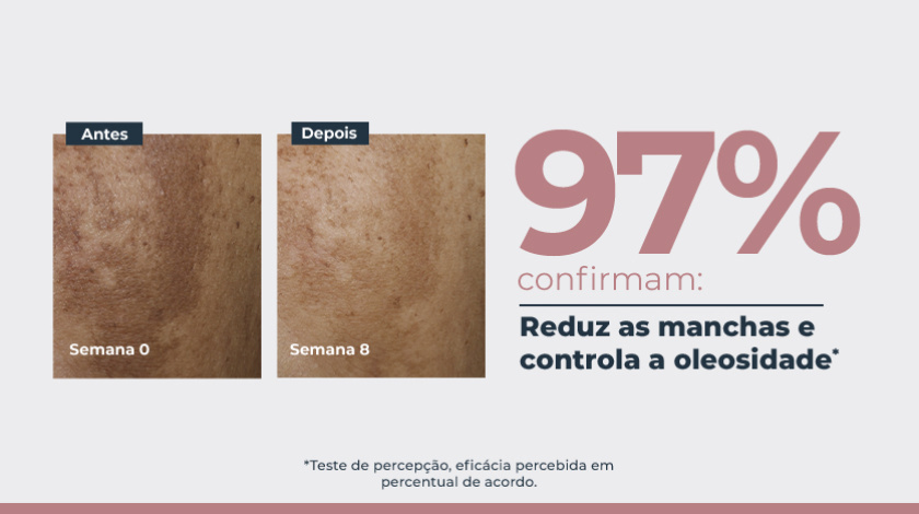 Imagem comparativa de pele em duas fotos lado a lado. À esquerda, a pele apresenta manchas escuras visíveis, marcada como ‘Semana 0’. À direita, a mesma área da pele após tratamento, na ‘Semana 8’, com aparência mais uniforme e manchas reduzidas. Ao lado direito das fotos, um grande número em destaque mostra ‘97%’, acompanhado de elementos gráficos e tipográficos.