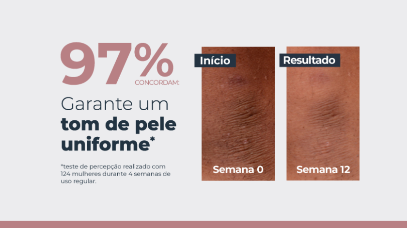 Comparativo de fotos de pele com manchas: à esquerda, pele com manchas visíveis antes do tratamento; à direita, pele mais uniforme após o uso do produto. Fundo claro com destaque para o percentual de eficácia.