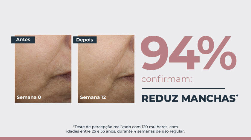 Imagem comparativa de pele em duas fotos lado a lado. À esquerda, a pele apresenta manchas escuras visíveis, marcada como ‘Semana 0’. À direita, a mesma área da pele após tratamento, na ‘Semana 12’, com aparência mais uniforme e manchas reduzidas. Ao lado direito das fotos, um grande número em destaque mostra ‘94%’, acompanhado de elementos gráficos e tipográficos.