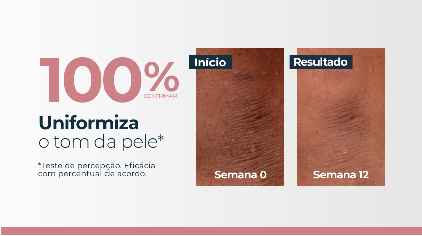 Imagem comparativa de pele em duas fotos lado a lado. À esquerda, a pele apresenta manchas escuras visíveis, marcada como ‘Semana 0’. À direita, a mesma área da pele após tratamento, na ‘Semana 12’, com aparência mais uniforme e manchas reduzidas. Ao lado direito das fotos, um grande número em destaque mostra ‘100%’, acompanhado de elementos gráficos e tipográficos.