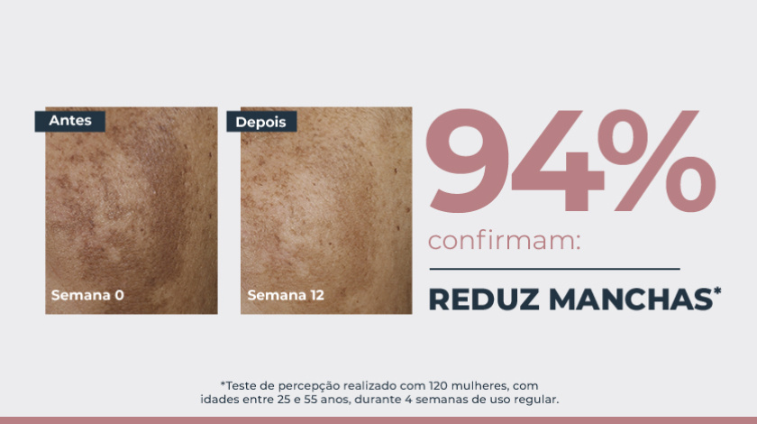 Imagem comparativa de pele em duas fotos lado a lado. À esquerda, a pele apresenta manchas escuras visíveis, marcada como ‘Semana 0’. À direita, a mesma área da pele após tratamento, na ‘Semana 12’, com aparência mais uniforme e manchas reduzidas. Ao lado direito das fotos, um grande número em destaque mostra ‘94%’, acompanhado de elementos gráficos e tipográficos.