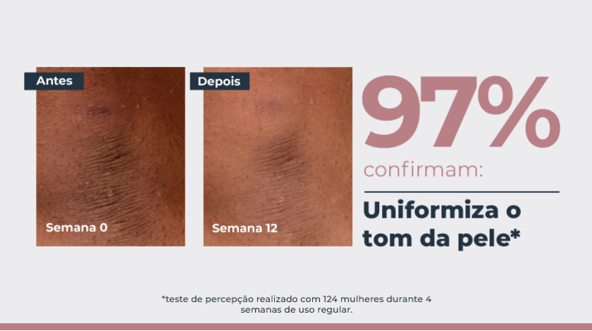 Imagem comparativa de pele em duas fotos lado a lado. À esquerda, a pele apresenta manchas escuras visíveis, marcada como ‘Semana 0’. À direita, a mesma área da pele após tratamento, na ‘Semana 12’, com aparência mais uniforme e manchas reduzidas. Ao lado direito das fotos, um grande número em destaque mostra ‘97%’, acompanhado de elementos gráficos e tipográficos.