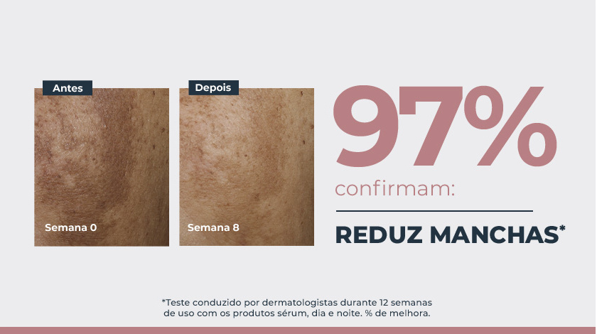 Imagem comparativa de pele em duas fotos lado a lado. À esquerda, a pele apresenta manchas escuras visíveis, marcada como ‘Semana 0’. À direita, a mesma área da pele após tratamento, na ‘Semana 8’, com aparência mais uniforme e manchas reduzidas. Ao lado direito das fotos, um grande número em destaque mostra ‘97%’, acompanhado de elementos gráficos e tipográficos.