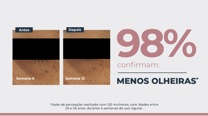 Imagem comparativa de pele em duas fotos lado a lado. À esquerda, a pele apresenta manchas escuras visíveis, marcada como ‘Semana 0’. À direita, a mesma área da pele após tratamento, na ‘Semana 12’, com aparência mais uniforme e manchas reduzidas. Ao lado direito das fotos, um grande número em destaque mostra ‘98%’, acompanhado de elementos gráficos e tipográficos.