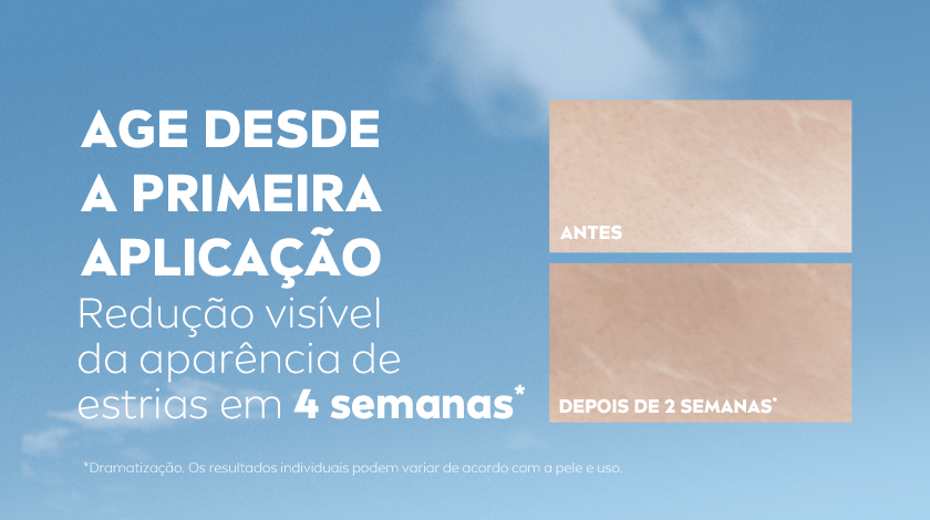 Fundo azul suave com imagem comparativa de pele: à esquerda, marca “ANTES” com estrias visíveis, à direita, imagem “DEPOIS DE 2 SEMANAS” com aparência mais uniforme.